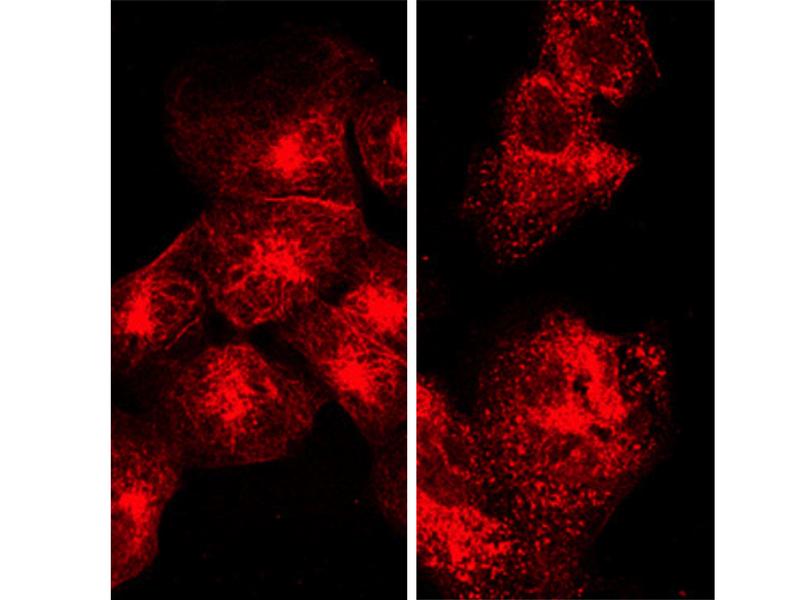 Mikroskopische Darstellung der Mikrotubuli in unbehandelten (links) oder mit Bcr-TMP behandelten Zellen (rechts).