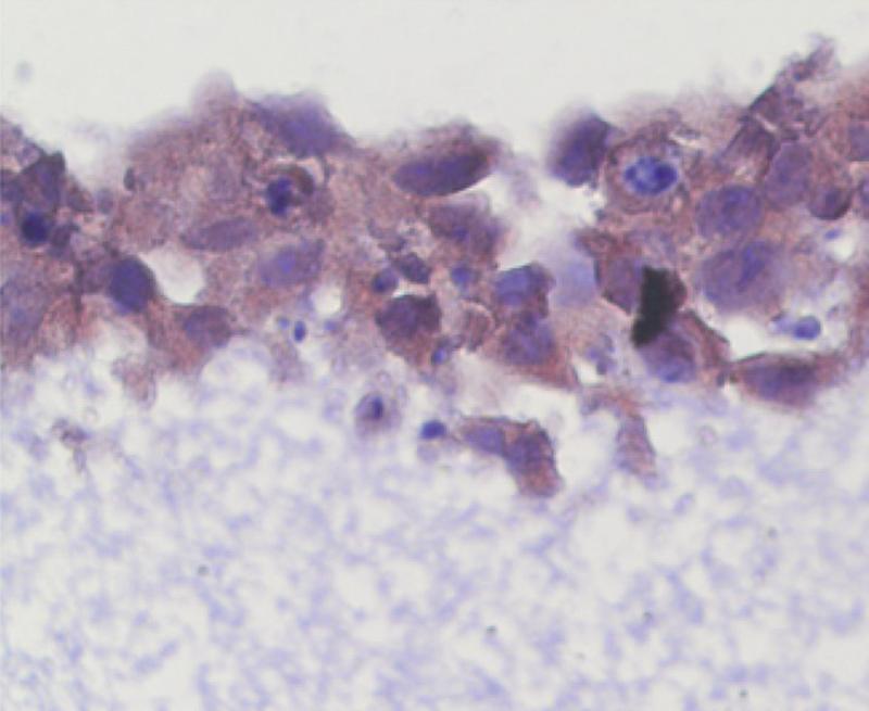 Section of the 3D model of the skin. Integrity of the upper cell layers is disturbed due to the lack of ISG15.