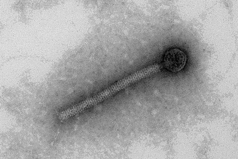 Transmission-electron micrograph of a bacteriophage