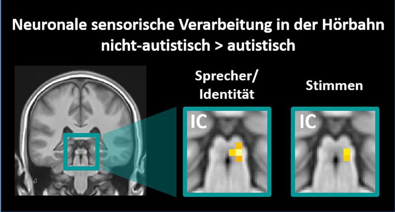 Aktivierung der „unteren Hügelplatte“ (Colliculi inferiores [IC])