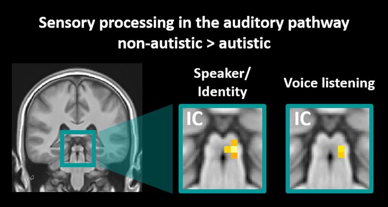 Study participants with an autism spectrum diagnosis had lower responses of the inferior colliculi (IC) in comparison to the non-autistic control group.