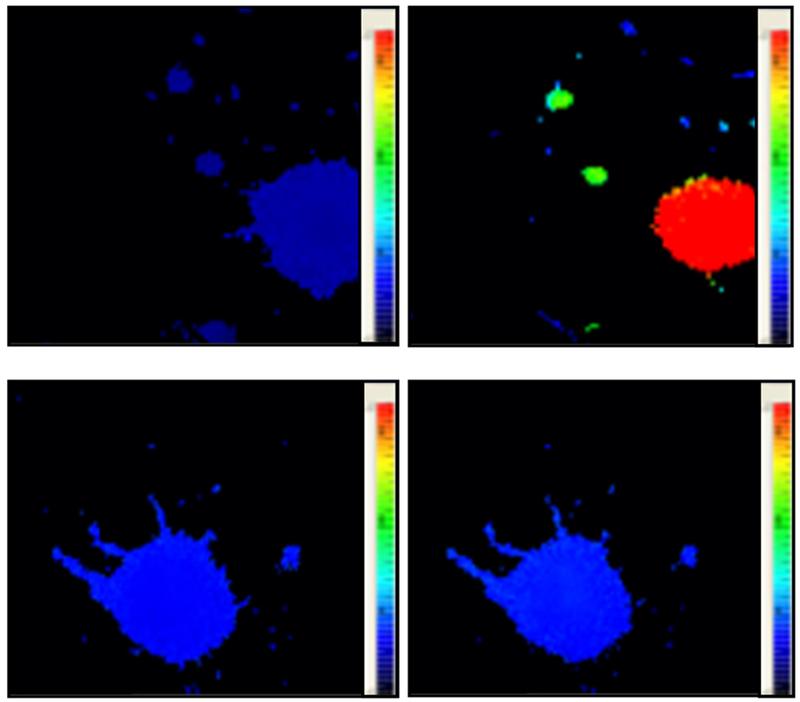 Die Eigenschaften einer Hirnzelle ändert sich drastisch (Farbumschlag zu rot), nachdem Rotenon zugegeben wurde, das die Bedingungen einer Parkinsonerkrankung imitiert (obern). Aktiviert man Ionenkanäle (unten), so bleibt die Umstellung aus (untere Reihe).
