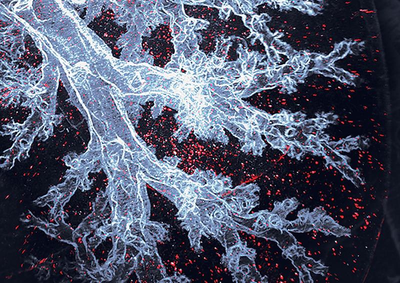 Alveolarmakrophagen sind die Immunzellen, die speziell in den Lungenbläschen leben, hier als rote Punkte in einer ansonsten transparenten Mauslunge sichtbar.