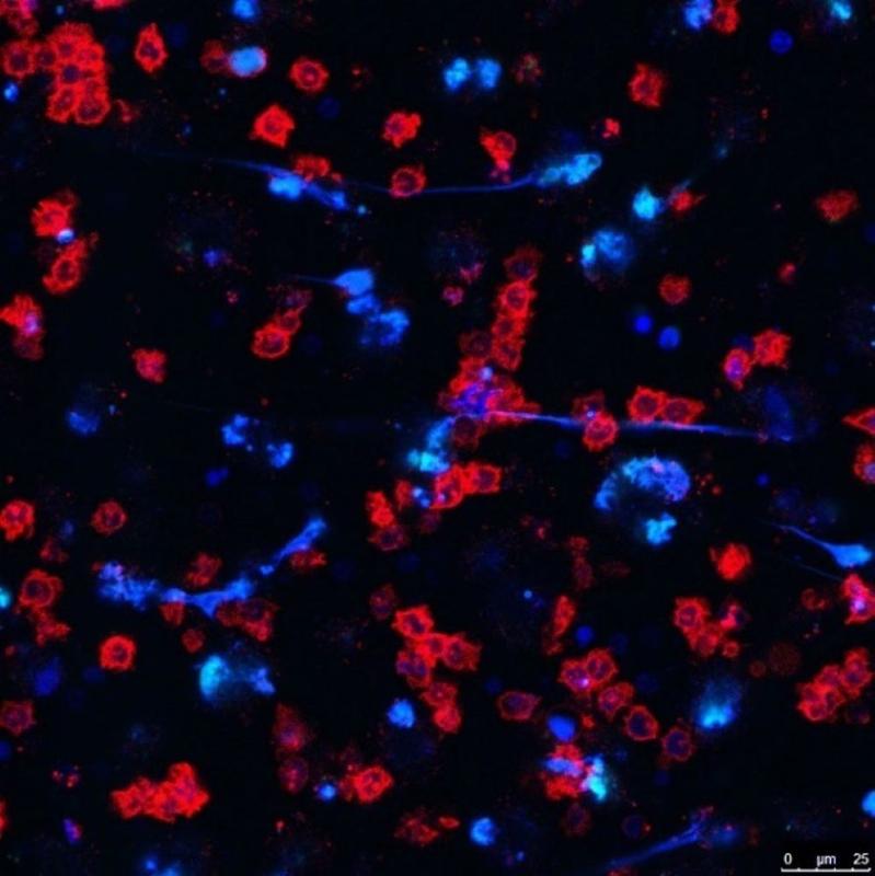 Darstellung von Neutrophilen (rot), die ein antimikrobielles Netz (blau) aus Proteinen und DNA, sog. Neutrophil Extracellular Traps, freisetzen. 