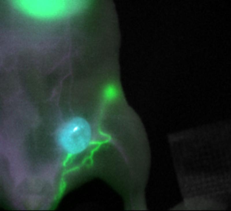 Die innovative Fluoreszenbildgebung macht Tumor (blau), Lymphgefäße (grün) und Blutgefäße (magenta) sichtbar. 
