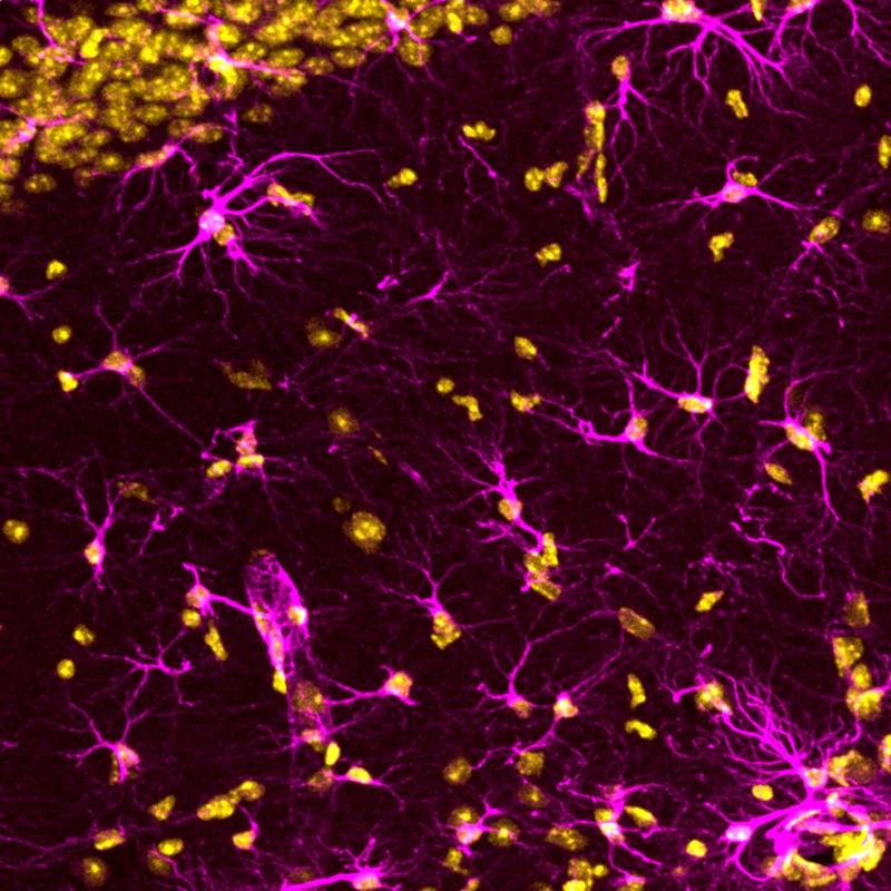 Fluoreszenzmikroskpo-Aufnahme von Astrozyten (violett) und ihren Zellkernen (gelb) im Mäusehirn.