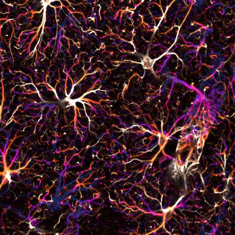 Network of astrocytes in the hippocampus of a mouse under the fluorescence microscope