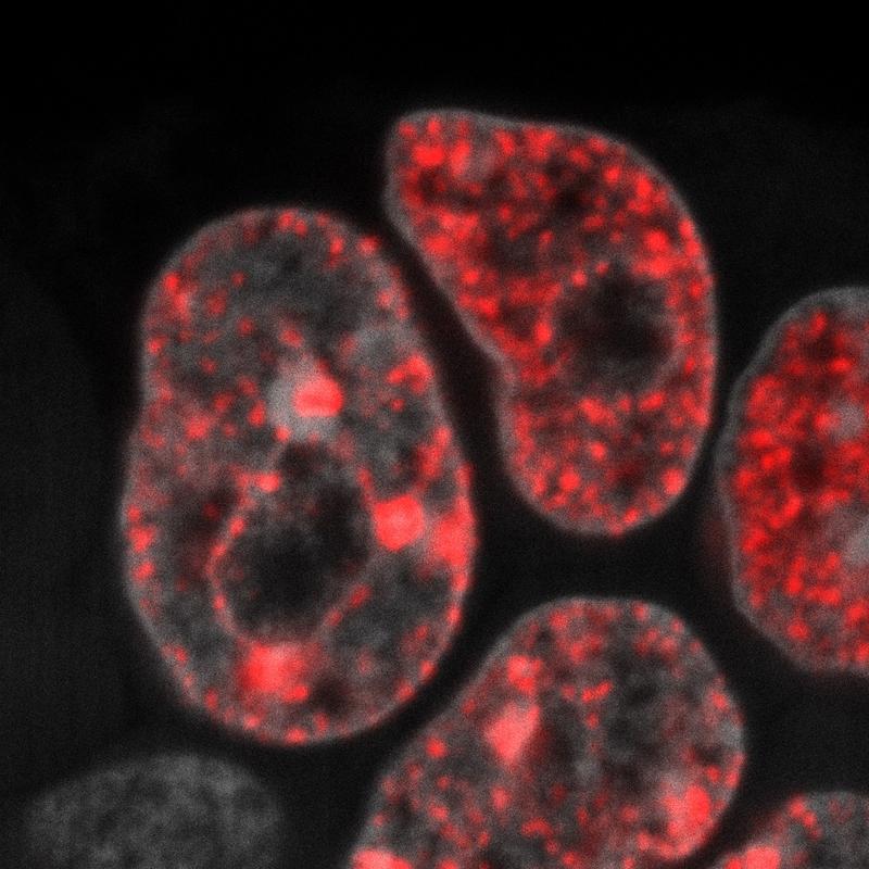  	 DNA-Replikation in embryonalen Stammzellen der Maus (rot: neu synthetisierte DNA). 