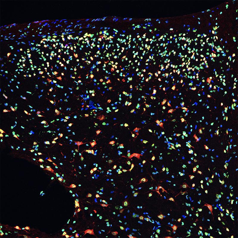 Section of mouse dorsal horn spinal cord. Blue marks cell nuclei, red the neurons. Green highlights the acetylation level of histone 3, used to measure the activity of HDAC4.