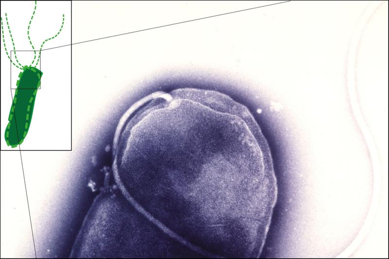Die EM-Aufnahme (violett) zeigt das Ende eines stäbchenförmigen Helicobacter pylori-Bakteriums, an dem ein Flagellum angeheftet ist. Bildausschnitt links: Schema einer Bakterienzelle mit Propellerflagellen.