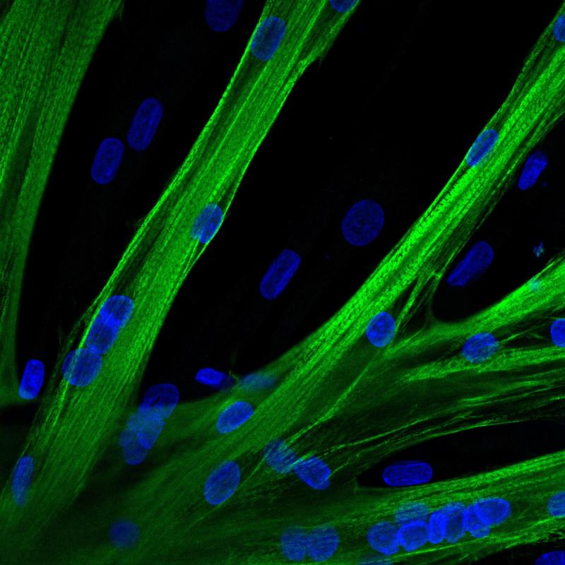 Die Forscher*innen schleusten CRISPR/Cas9 mithilfe von mRNA in die Muskelstammzellen. Nach der Genomeditierung verschmolzen die Stammzellen zu mehrkernigen Fasern (Myotuben). In grün ist eine schwere Kette Myosin zu sehen; in blau die Zellkerne.