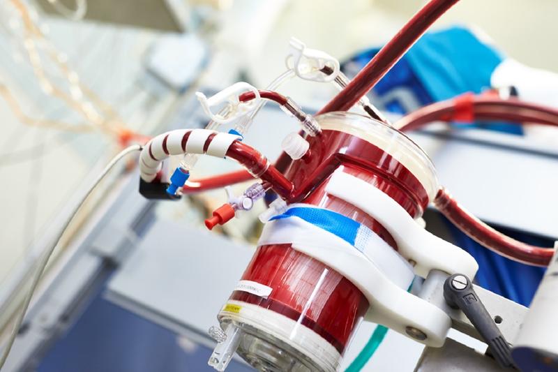 Mit Pandemiebeginn rückte die ECMO-Therapie in den öffentlichen Fokus. Viele Patienten mit einer schweren COVID-19-Infektion konnten und können nur noch so versorgt werden. Die jahrelange ECMO-Expertise kommt den Experten hier zugute.