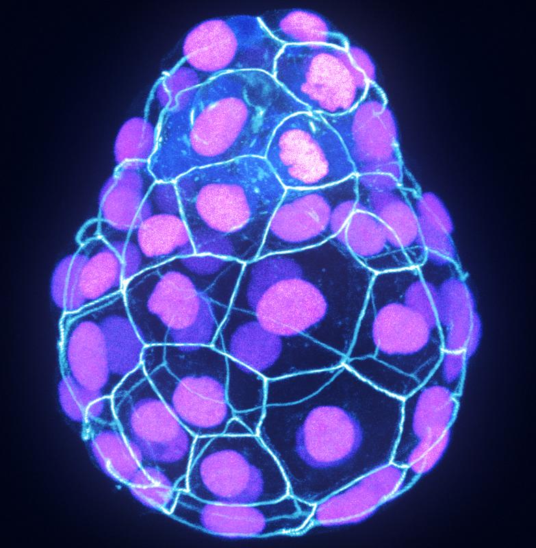 Mouse embryo at blastocyst stage of development. The pluripotent cells are positioned inside the embryo, surrounded by cells marked in magenta.