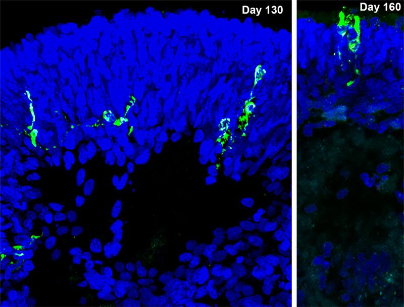 SARS-CoV-2-infected cells (green; immunofluorescence) in retinal organoids. The SARS-CoV-2 infected cells in the right figure show the typical morphology of photoreceptors.