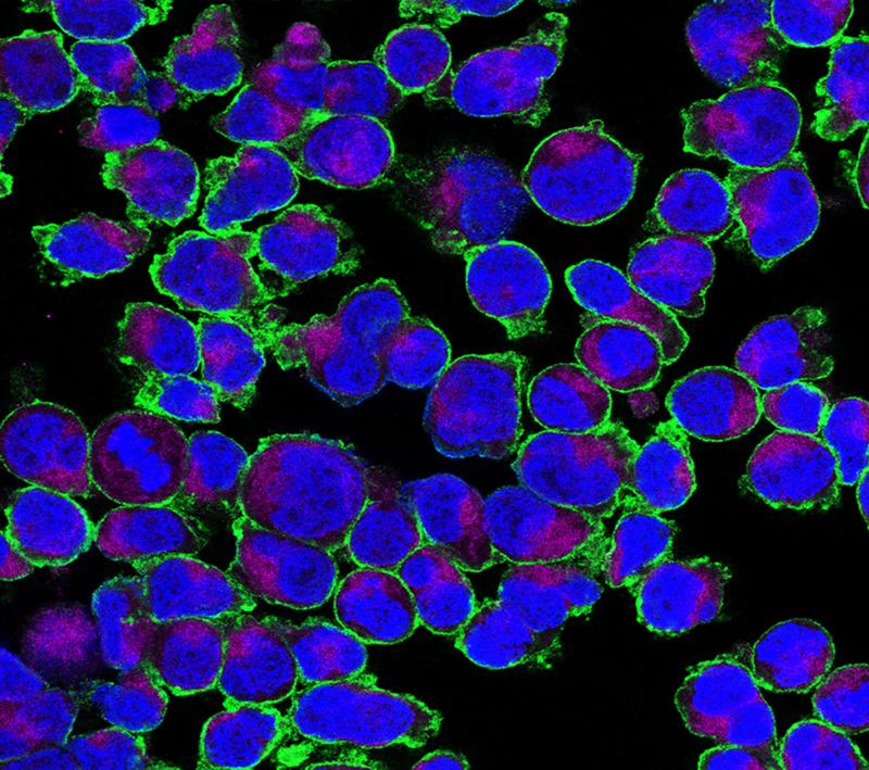 Expression von GLUT3 auf aktivierten T-Zellen. GLUT3 (grün) ist auf der Zelloberfläche lokalisiert, die Mitochondrien (violett) und der Kern (blau) wurden ebenfalls dargestellt. 