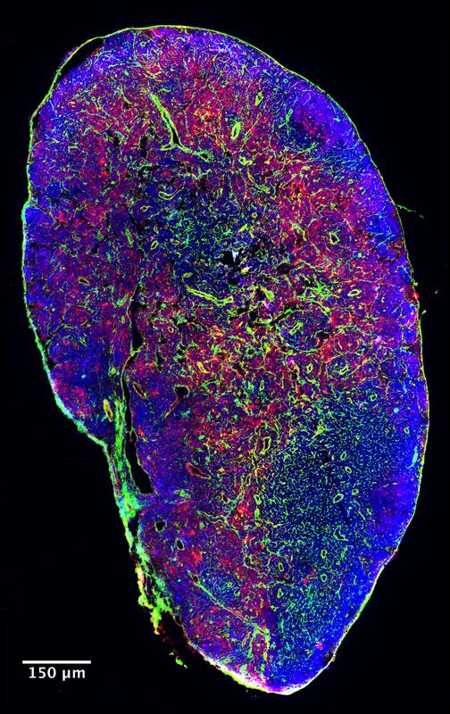 Immunfluoreszenz-Bild von einem Lymphknoten.