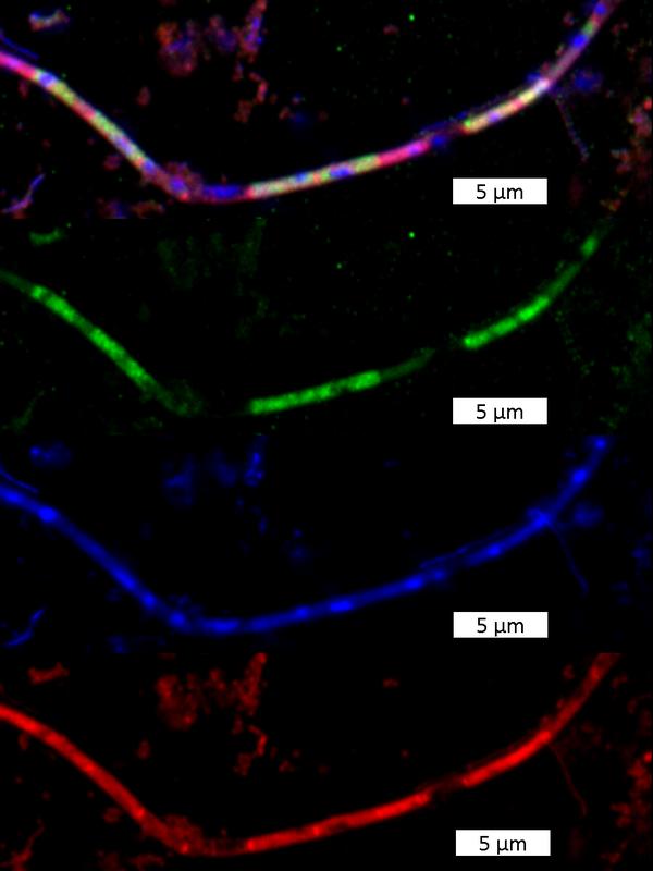 Fluoreszenzmikroskopische Aufnahmen von Methanosaeta, einer filamentösen methanogenen Archaee. Die einzelnen Aufnahmen zeigen jeweils die gleichen Zellen in verschiedenen Färbungen.