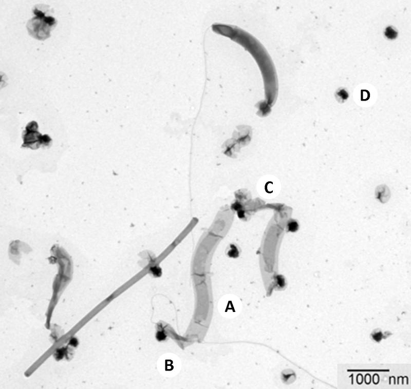 Electron microscope image of the enrichment culture from the sewage treatment plant.