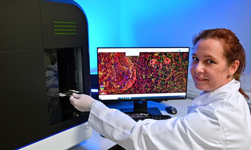 Das Forschungsteam der Pathologie am Uniklinikum Jena, hier Labormitarbeiterin Dagmar Samsel, nutzt einen Multispektral-Fluoreszenz-Scanner, um die Mechanismen der Tumorentstehung in Gewebepräparaten zu untersuchen.