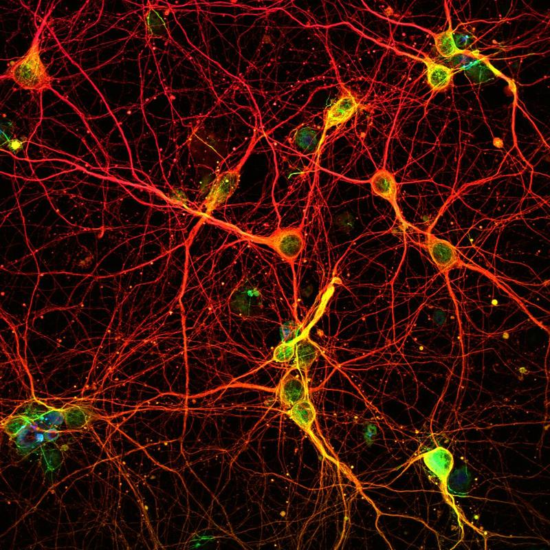 Neurons in the mouse cortex.