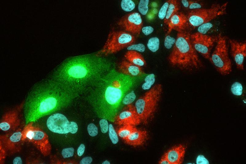  Replikation von Hepatitis C virus (HCV) und Heaptitis E Virus (HEV) in humanen Leberzellen. HCV leuchtet bei erfolgreicher Vermehrung rot, HEV grün. 
