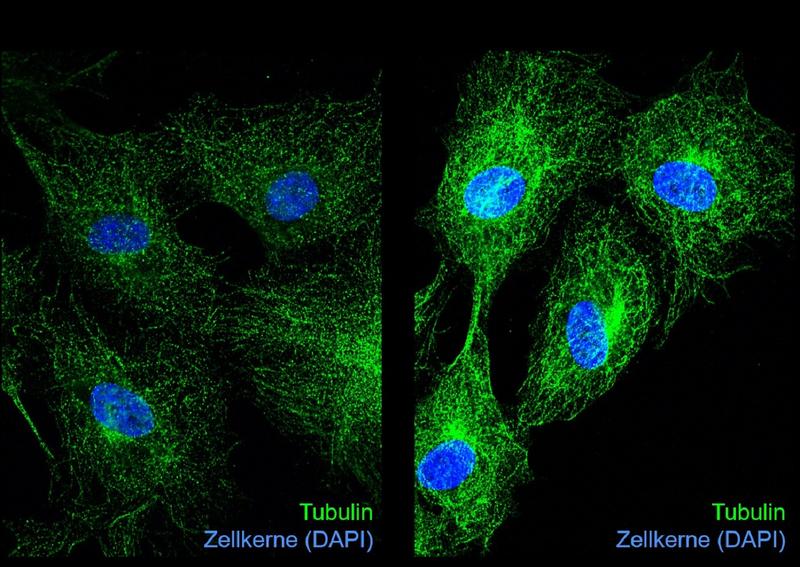 Immunfluoreszenzaufnahmen von Tubulin (grün) und Zellkernen (blau) in unbehandelten (links) und Glyoxal-behandelten Endothelzellen (rechts). Die Glykierung von Tubulin durch Glyoxal führt zu veränderter Mikrotubuli-Dynamik und Hemmung der Zellteilung.