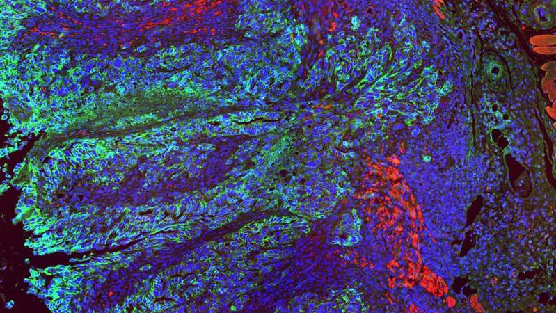 A multi-color image of colon tissue. Single cell nuclei are visible in blue. Colon cancer cells are highlighted in green. The cells infiltrate the organ lining and the muscle layers (red), ultimately leading to cancer cell migration into other organs.