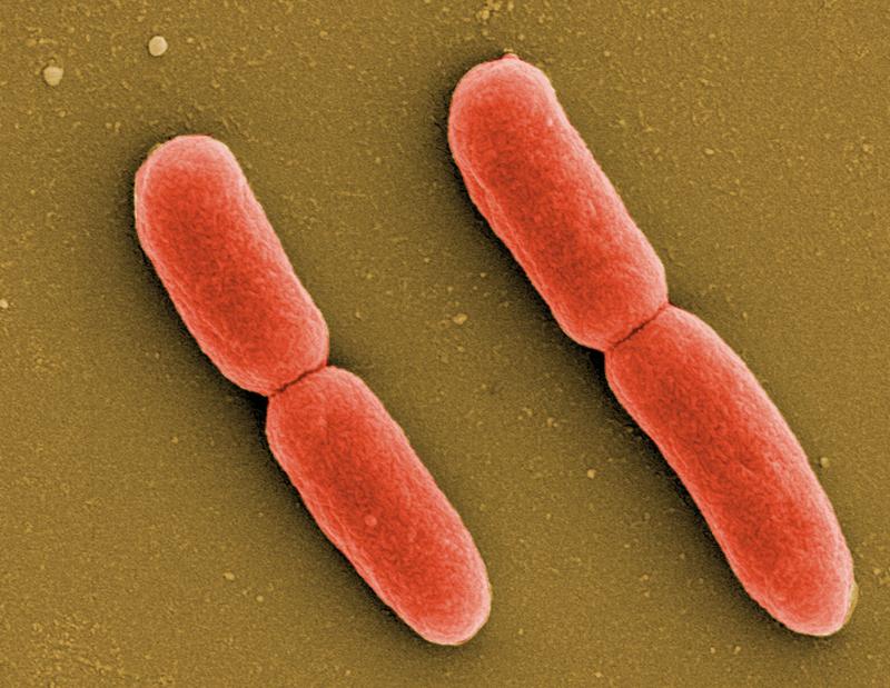 E. coli bacteria in the electron microscope