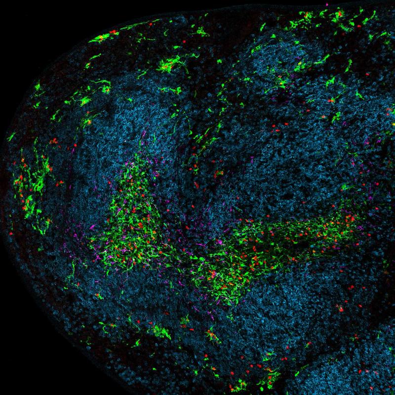 Ein Teil der Milz während einer chronischen Virusinfektion. Dendritische Zellen sind grün, Killer-T-Zellen rot, B-Zellen blau und Stromazellen magenta dargestellt. 
