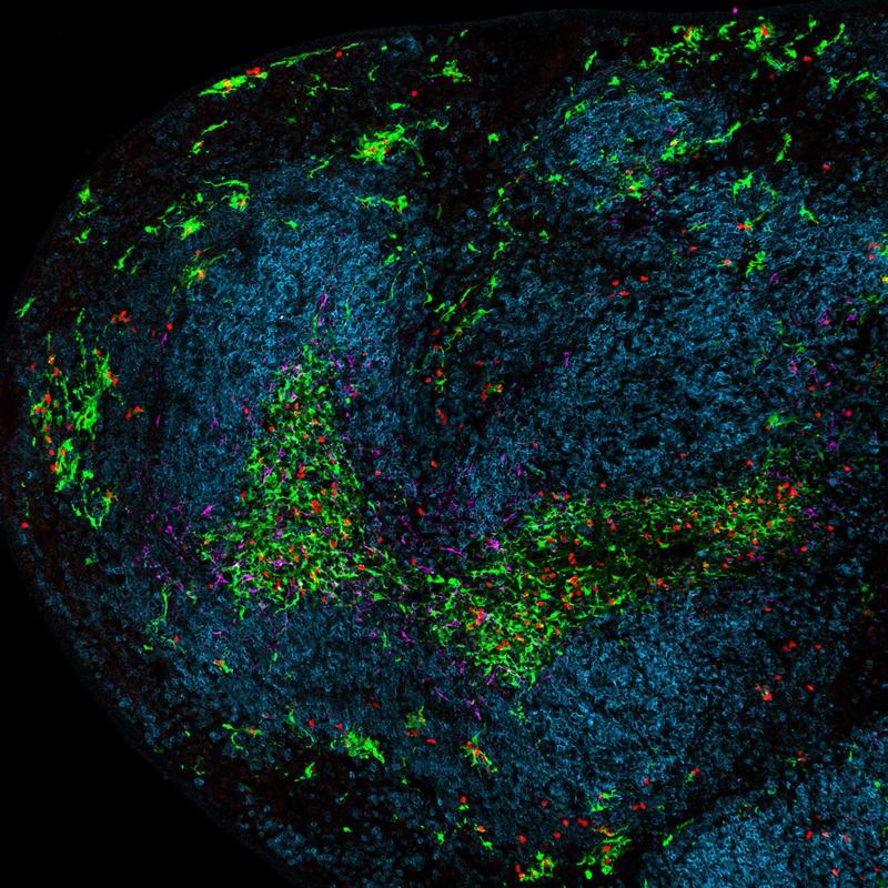 A part of the spleen during chronic viral infection. Dendritic cells are green, Killer T cells are red, B cells are blue and stromal cells are magenta.