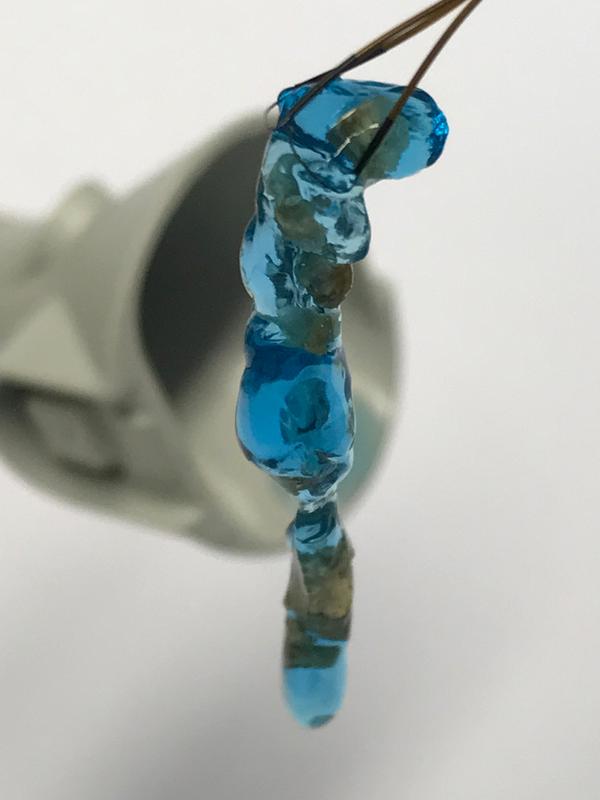mediNiK® in use: the hydrogel with encapsulated kidney stone fragments following removal from the kidney.