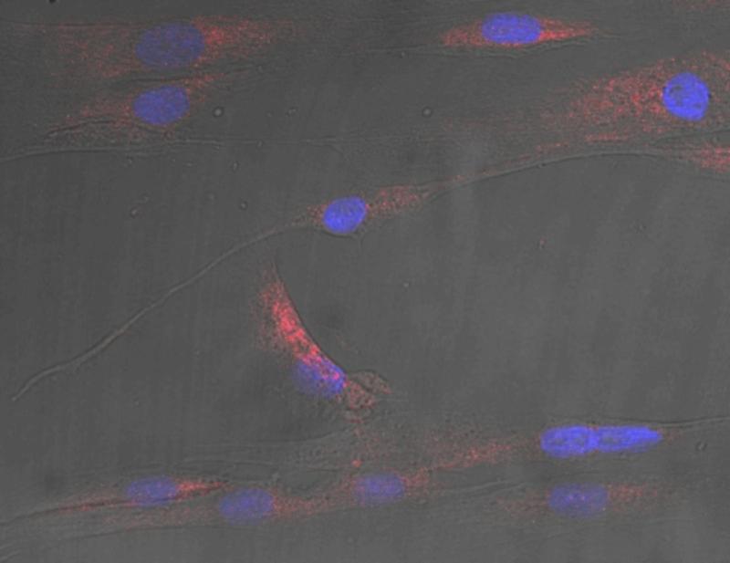 Microscopy image showing human muscle cells with nuclei in blue, and stress caused by the ceramide stress signals shown in red.