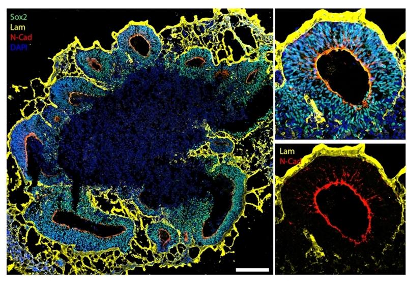 Brain organoids in detail. Using specific protein markers, it is possible to observe structural details of organoids (yellow  and red) as well as all the organoid cells in blue and green. 