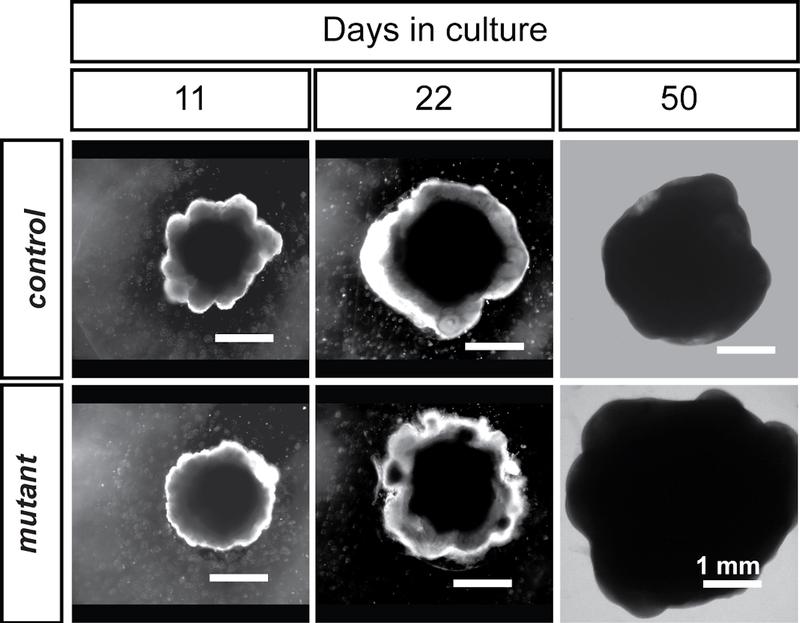 Organoid development. At day 50, it is possible to notice the overgrowth of mutant organoids when compare to the control group. 