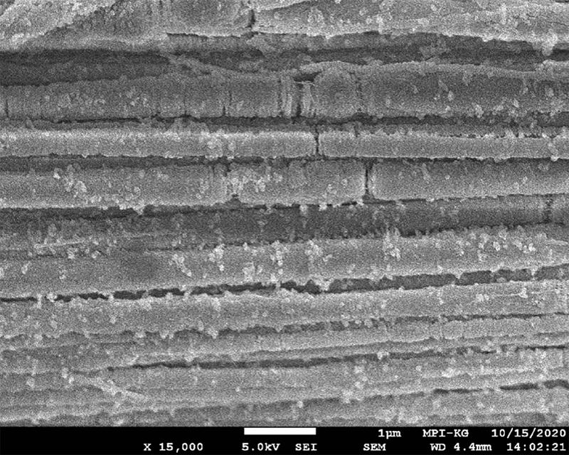 Kollagenfaserbündel nach der Mineralisation mit Strontium-Karbonat