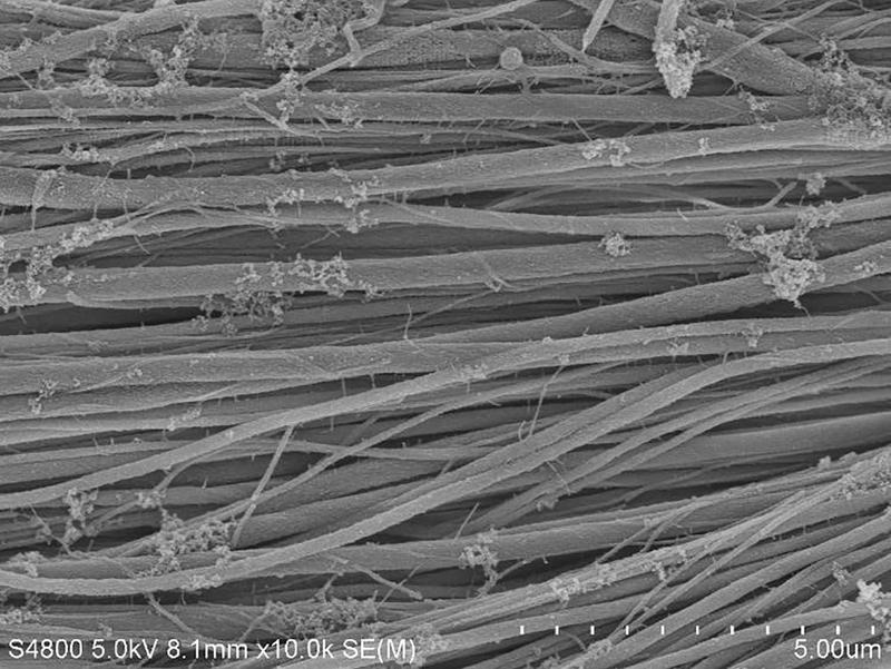 Collagen fiber bundles after mineralization with (the bone mineral) calcium phosphate.