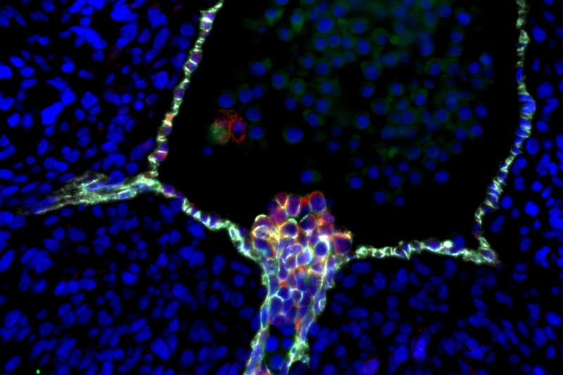 Immunfluoreszenz Färbung eines intra-aorten hämatopoetischen Zellclusters. Die Abbildung wurde von Simone Liebscher aufgenommen, Institut für Biomedical Engineering, Universität Tübingen.