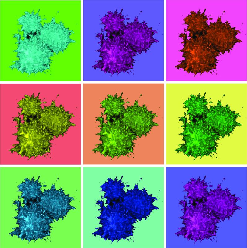ASC-Specks - hier in verschiedenen Farben dargestellt - sind große Komplexe vieler Kopien des ASC-Proteins. Im Gewebe können sie immensen Schaden anrichten. (c) AG Franklin / Universität Bonn