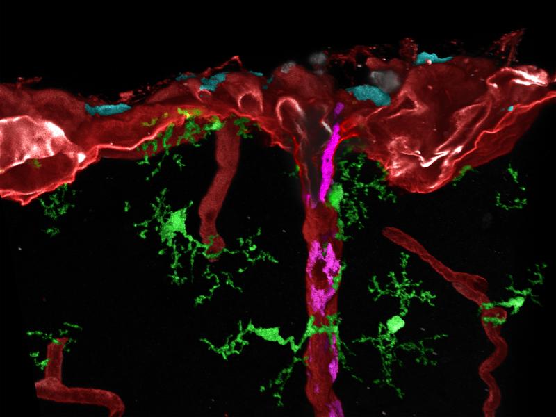 Nachbearbeitete mikroskopische Aufnahme verschiedener Gewebsmakrophagen (cyan, magenta oder grün) im Maushirn. Makrophagen (magenta) an Blutgefäßen entstehen durch Einwandern von Makrophagen (cyan) aus den Hirnhäuten.