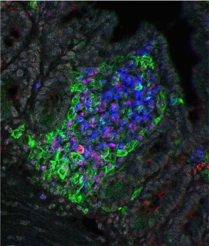 Unter dem Epithel des Dünndarms liegendes lymphoides Cluster, bestehend aus einer Ansammlung von ILC (blau, violett), umgeben von einer Population dendritischer Zellen (grün). Diese Cluster regulieren die Funktion des Darmepithels bei der Aufnahme v