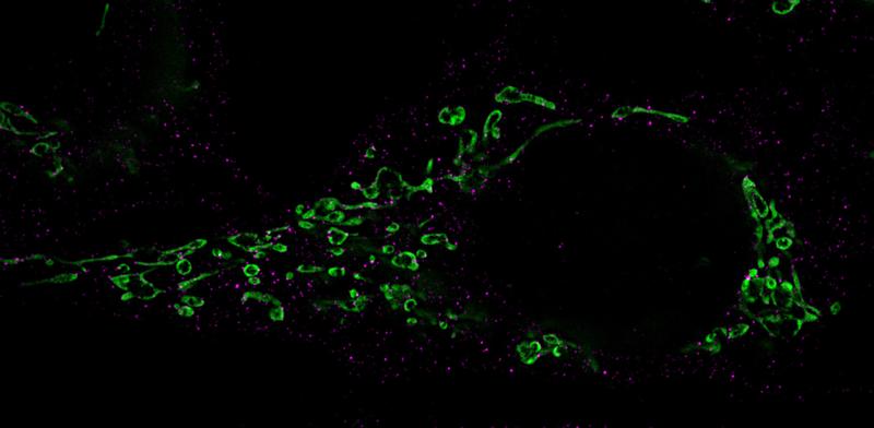 Fragmentierung von Mitochondrien (grün): Die für den Zerfall verantwortlichen Drp-1-Proteine sind mit Antikörpern markiert und in Magenta gefärbt.