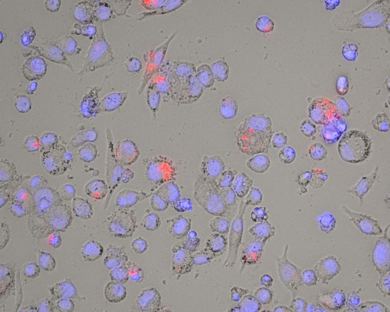 Anders als andere Bakterien kann M. abscessus Makrophagen, die Fresszellen des Immunsystems, befallen und wird von ihnen nicht zersetzt. Im Bild sind die Bakterien rot eingefärbt und befinden sich in den Makrophagen, deren Zellkerne blau markiert sind.
