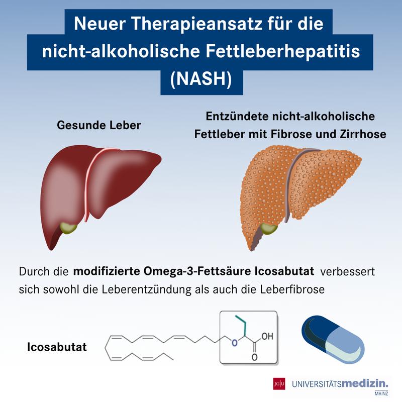 Für die Behandlung einer nicht-alkoholischen Fettleberhepatitis (NASH) haben Forschende der Universitätsmedizin Mainz die modifizierte Omega-3-Fettsäure Icosabutat entwickelt. Der innovative Wirkstoff hemmt die Entzündung und Vernarbung der Leb