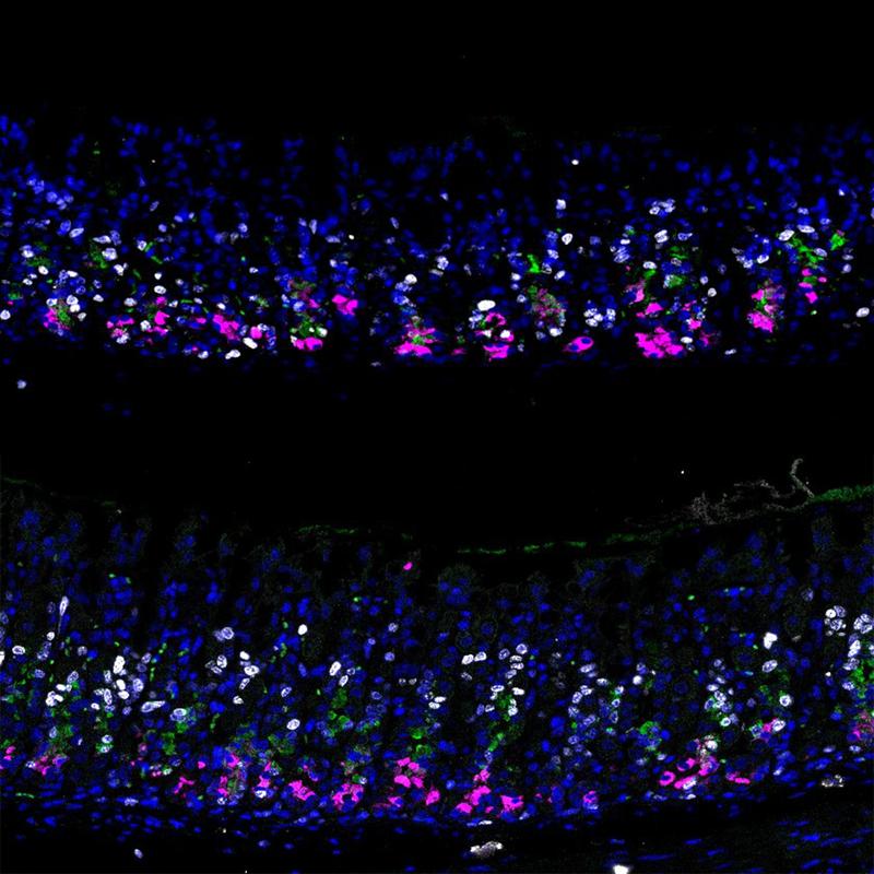 Mouse stomach normal epithelium vs. p57 overexpression dpi3