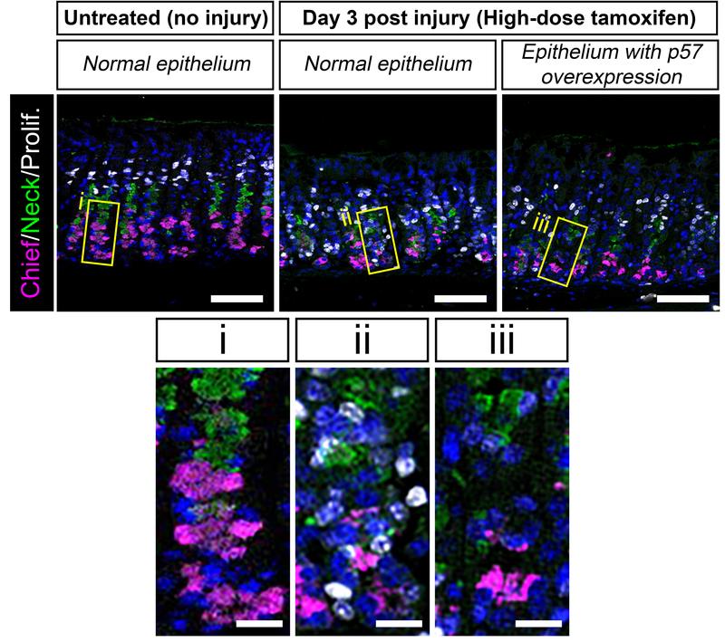 Mouse stomach epithelium control vs. injury, labeled