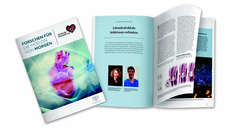 Über die Forschungsförderung der Deutschen Herzstiftung und der Deutschen Stiftung für Herzforschung informiert die Broschüre „Forschen für die Medizin von morgen“. 