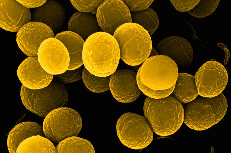 lectron micrograph of Staphylococcus aureus, one of the pathogens that the new probes can detect.