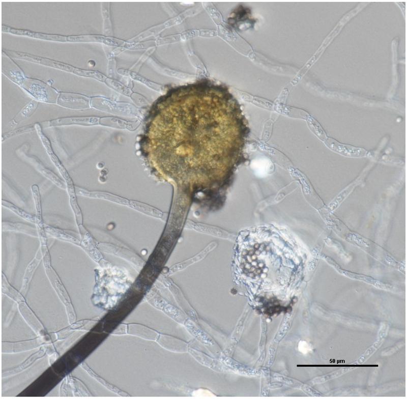 Aspergillus aculeatus, ein Pilz, der im Wasser an der Zersetzung von Pflanzen und am Nährstoffkreislauf beteiligt ist. Die Autor*innen rufen dazu auf, die ökologische Rolle von Wasserpilzen stärker in den Blick zu nehmen.