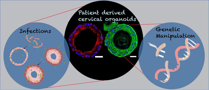 Das Bild zeigt endozervikale säulenförmige (rot) und ektozervikale geschichtete Plattenepithelorganoide (grün) des weiblichen Fortpflanzungstrakts. Das Diagramm verdeutlicht deren Rolle für genetische Manipulationen und bei Infektionen.