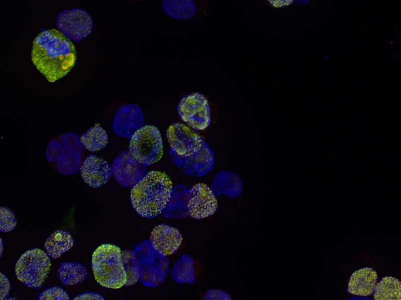 Blick ins Mikroskop: Man sieht menschliche Zellen in der Petrischale. Gelb gefärbt sind die acetylierten TDP-43-Proteinklümpchen, blau gefärbt ist die DNA in den Zellkernen. 